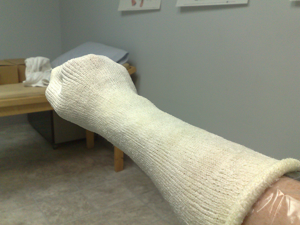 Wrist in Cast